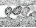 Lassa virus 병원체 이미지입니다. 