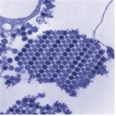 Chikungunya virus 병원체 이미지입니다. 
