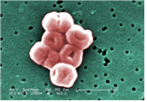 Acinetobacter baumannii 병원체 이미지입니다.