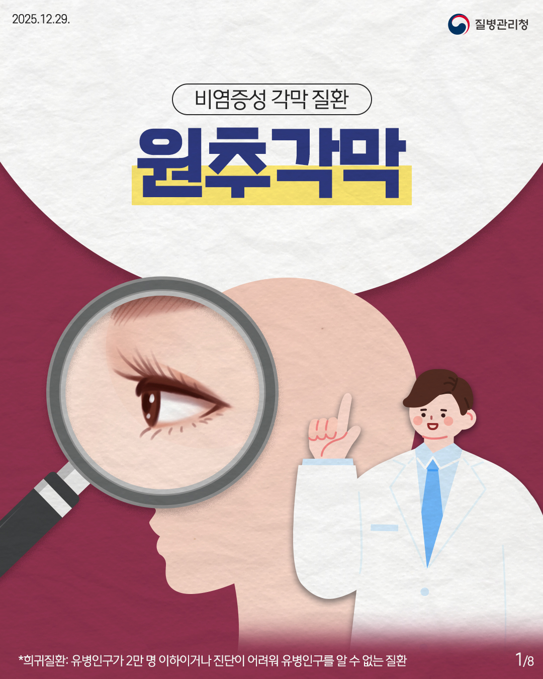 2025.11.27. 질병관리청  1P 비염증성 각막 질환 원추각막  *희귀질환: 유병인구가 2만 명 이하이거나 진단이 어려워 유병인구를 알 수 없는 질환
