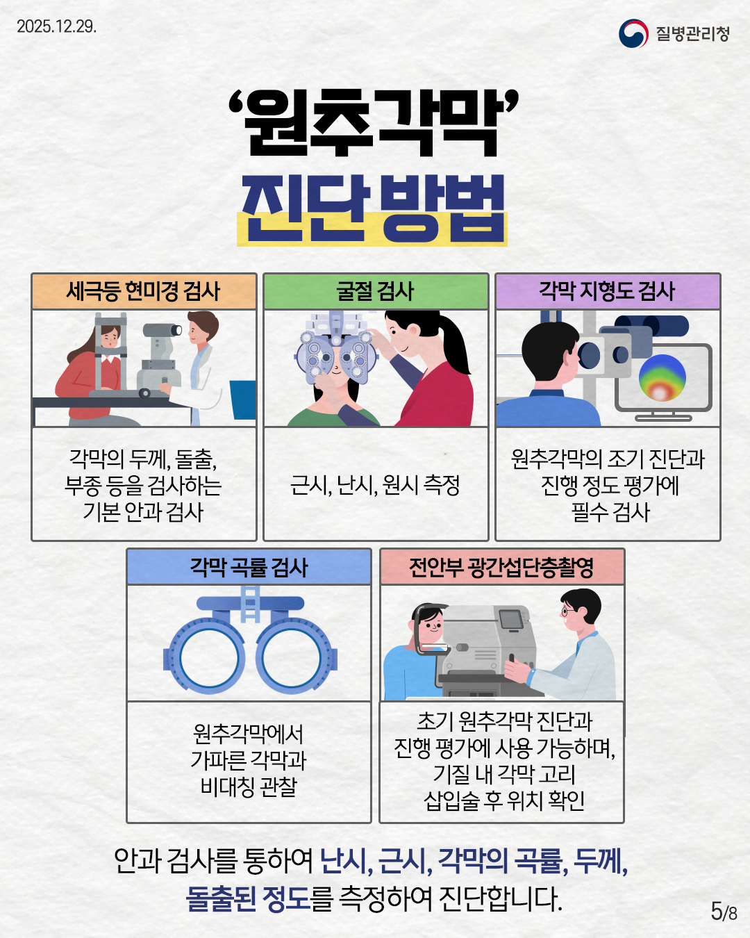 5P '원추각막' 진단방법  세극등 현미경 검사 각막의 두께, 돌출,  부종 등을 검사하는 기본 안과 검사  굴절 검사 근시, 난시, 원시 측정  각막 지형도 검사 원추각막의 조기 진단과 진행 정도 평가에  필수 검사  각막 곡률 검사 원추각막에서  가파른 각막과 비대칭 관찰  전안부 광간섭단층촬영 초기 원추각막 진단과 진행 평가에 사용 가능하며, 기질 내 각막 고리 삽입술 후 위치 확인   안과 검사를 통하여 난시, 근시, 각막의 곡률, 두께, 돌출된 정도를 측정하여 진단합니다. 