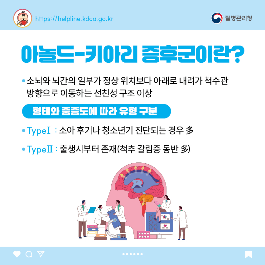 질병관리청 1. 아놀드-키아리 증후군이란? - 소뇌와 뇌간의 일부가 정상 위치보다 아래로 내려가 척수관 방향으로 이동하는 선천성 구조 이상 <형태와 중증도에 따라 유형 구분> - TypeⅠ : 소아 후기나 청소년기 진단되는 경우 多 - TypeⅡ : 출생시부터 존재(척추 갈림증 동반 多)