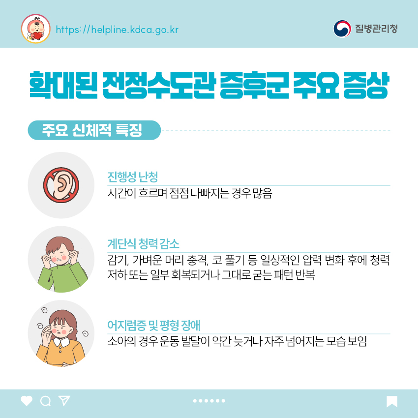 확대된 전정수도관 증후군 주요 증상 <주요 신체적 특징> - 진행성 난청 : 시간이 흐르며 점점 나빠지는 경우 많음 - 계단식 청력 감소 : 감기, 가벼운 머리 충격, 코 풀기 등 일상적인 압력 변화 후에 청력 저하 또는 일부 회복되거나 그대로 굳는 패턴 반복 - 어지럼증 및 평형 장애 : 소아의 경우 운동 발달이 약간 늦거나 자주 넘어지는 모습 보임