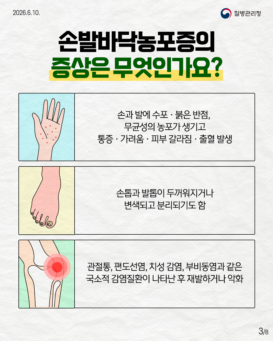 손발바닥농포증의 증상은 무엇인가요?  손과 발에 수포 &middot; 붉은 반점, 무균성의 농포가 생기고 통증 &middot; 가려움 &middot; 피부 갈라짐 &middot; 출혈 발생  손톱과 발톱이 두꺼워지거나 변색되고 분리되기도 함  관절통, 편도선염, 치성 감염, 부비동염과 같은 국소적 감염질환이 나타난 후 재발하거나 악화