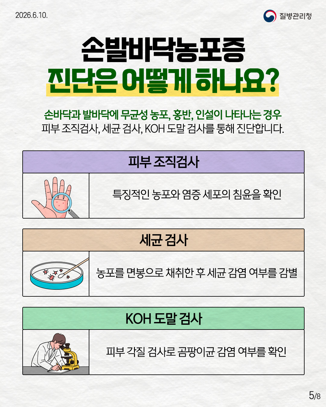 손발바닥농포증 진단은 어떻게 하나요?  손바닥과 발바닥에 무균성 농포, 홍반, 인설이 나타나는 경우 피부 조직검사, 세균 검사, KOH 도말 검사를 통해 진단합니다.  피부 조직검사 특징적인 농포와 염증 세포의 침윤을 확인  세균 검사 포를 면봉으로 채취한 후 세균 감염 여부를 감별  KOH 도말 검사 피부 각질 검사로 곰팡이균 감염 여부를 확인