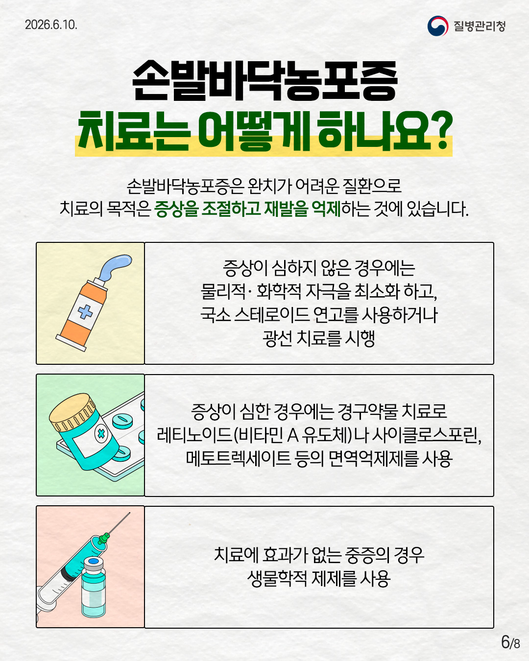 손발바닥농포증 치료는 어떻게 하나요?  손발바닥농포증은 완치가 어려운 질환으로 치료의 목적은 증상을 조절하고 재발을 억제하는 것에 있습니다.  증상이 심하지 않은 경우에는 물리적 &middot; 화학적 자극을 최소화 하고, 국소 스테로이드 연고를 사용하거나 광선 치료를 시행  증상이 심한 경우에는 경구약물 치료로 레티노이드(비타민 A 유도체)나 사이클로스포린, 메토트렉세이트 등의 면역억제제를 사용  치료에 효과가 없는 중증의 경우 생물학적 제제를 사용