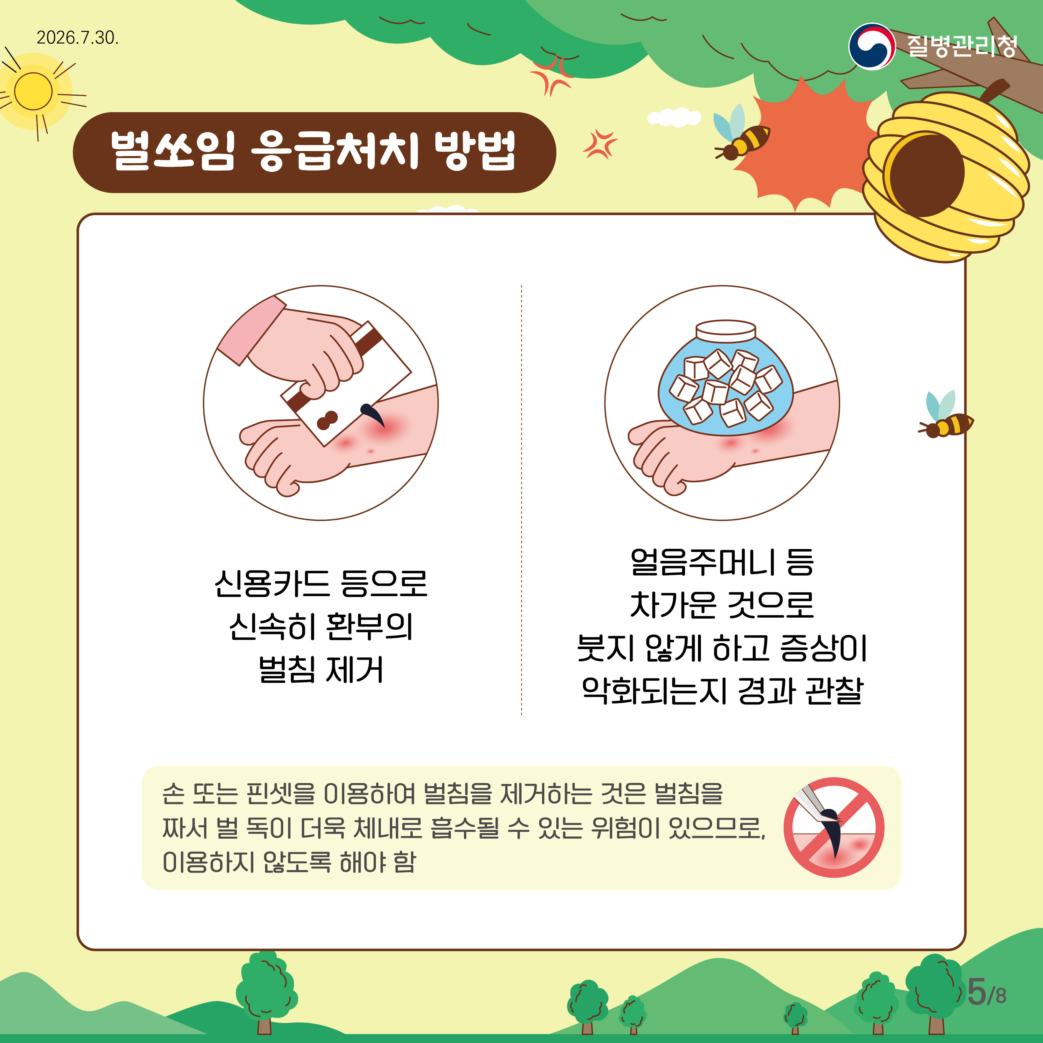 벌쏘임 응급처치 방법 신용카드 등으로 환부의 벌침 제거 얼음주머니 등 차가운 것으로 붓지 않게 하고 증상이 악화되는지 경과 관찰 손 또는 핀셋을 이용하여 벌침을 제거하는 것은 벌침을 짜서 벌 독이 더욱 체내로 흡수될 수 있는 위험이 있으므로, 이용하지 않도록 해야함