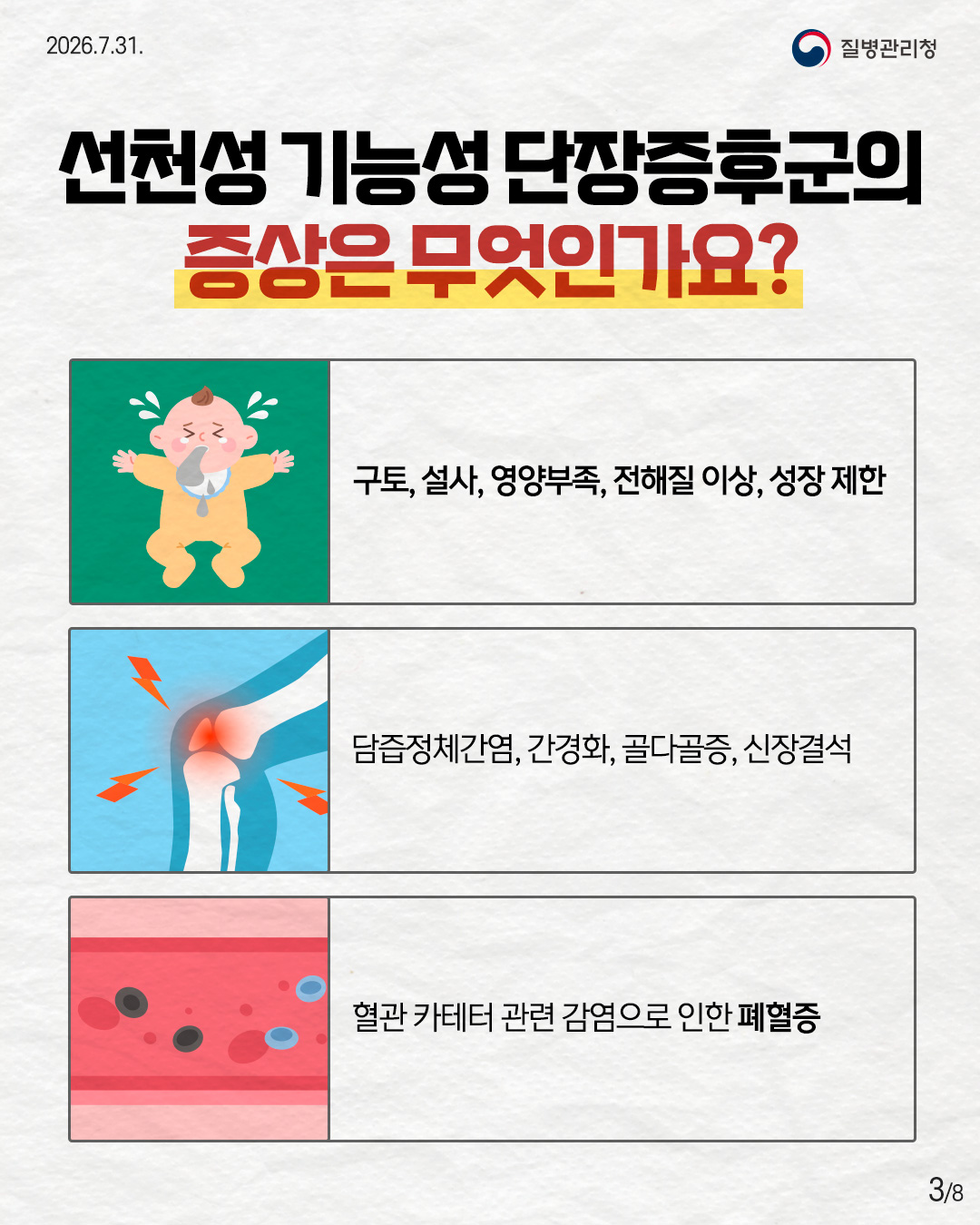 3페이지 선천선 기능성 단장증후군의 증상은 무엇인가요? 구토, 설사, 영양부족, 전해질 이상, 성장 제한 담즙정체간염, 간경화, 골다공증, 신장결석 혈관 카테터 관련 감염으로 인한 폐혈증 3/8