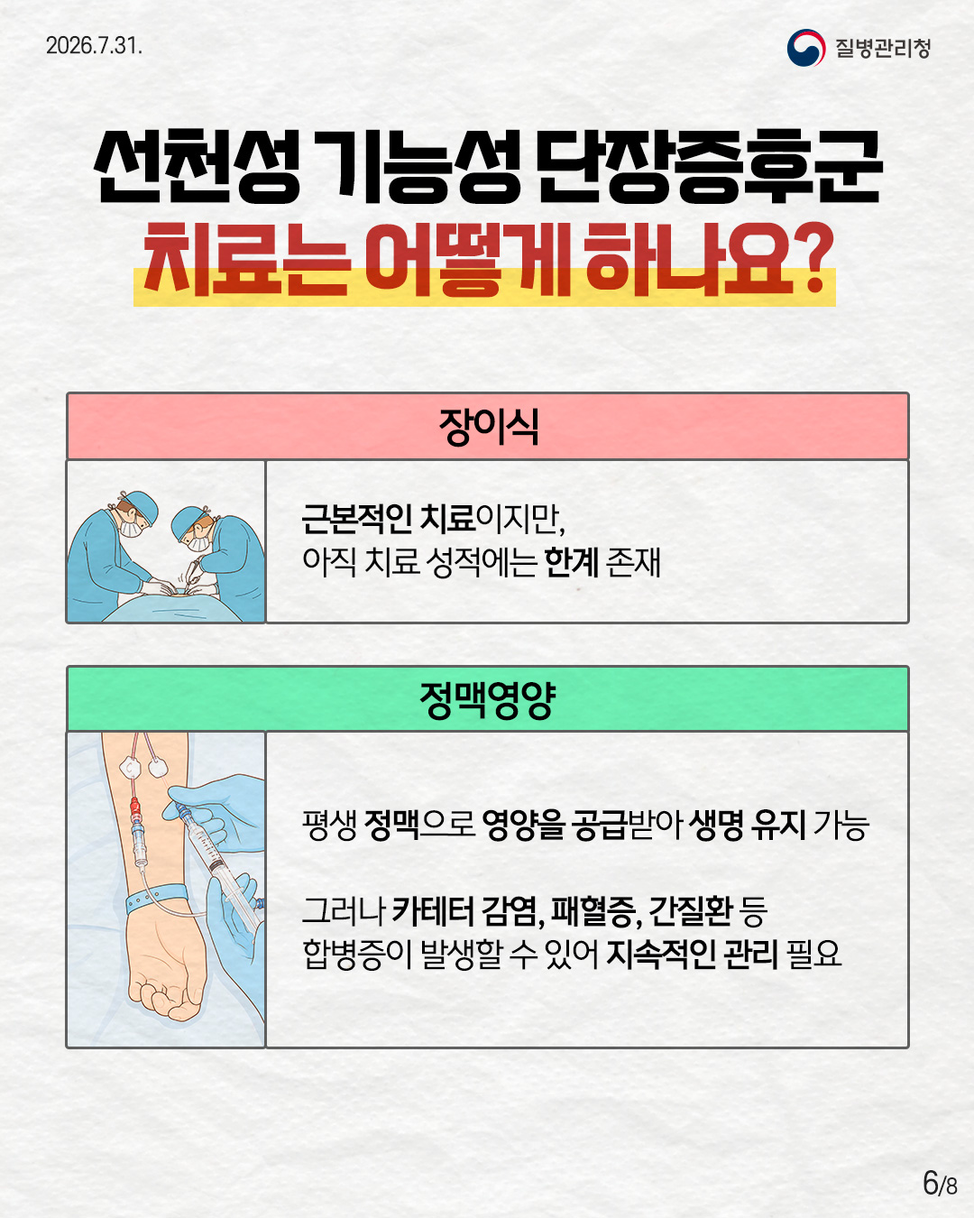 6페이지 선천성 기능성 단장증후군 치료는 어떻게 하나요? 장이식 근본적인 치료이지만, 아직 치료 성적에는 한계 존재 정맥영양 평생 정맥으로 영양을 공급받아야 생명 유지가 가능하며, 정맥 영양으로 인한 카테터 감염, 패혈증, 간질환 등 합병증이 발생할 수 있어 잦은 입원과 지속적인 관리 필요 6/8
