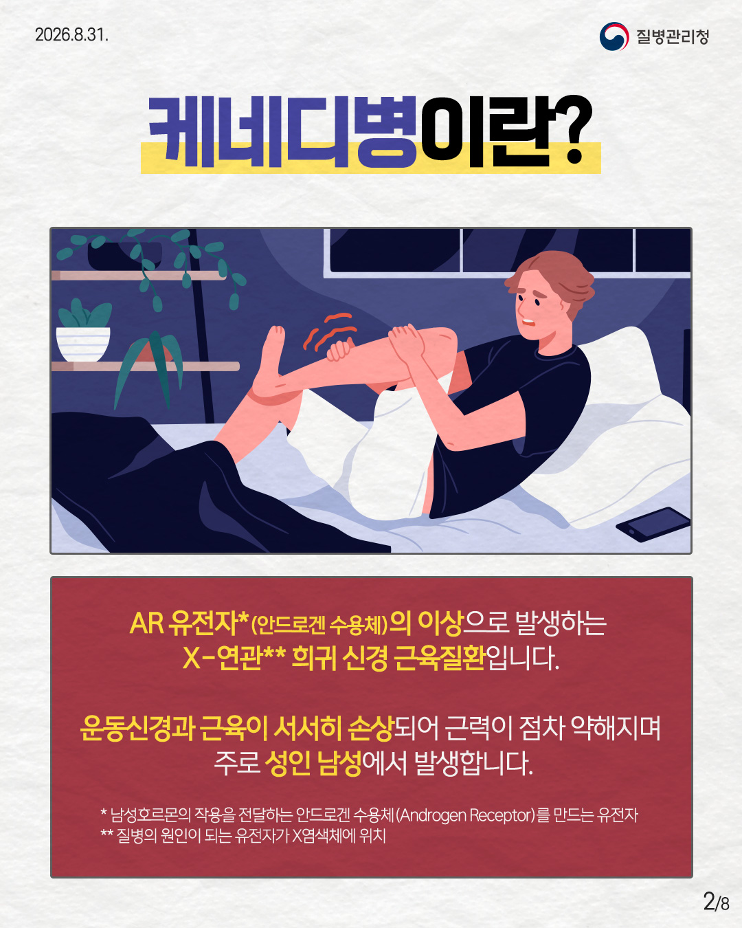 케네디병이란? AR유전자*(안드로겐 수용체)의 이상으로 발생하는 X-연관** 희귀 신경 근육질환입니다. 운동신경과 근육이 서서히 손상되어 근력이 점차 약해지며 주로 성인 남성에서 발생합니다. * 남성호르몬의 작용을 전달하는 안드로겐 수용체(Androgen Receptor)를 만드는 유전자 ** 질병의 원인이 되는 유전자가 X염색체에 위치