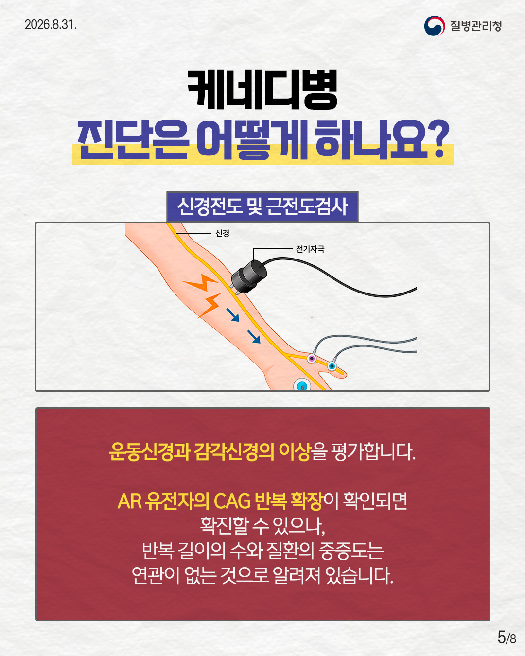 케네디병 진단은 어떻게 하나요? 신경전도 및 근전도검사 운동신경과 감각신경의 이상을 평가합니다. AR 유전자의 CAG 반복 확장이 확인되면 확진할 수 있으나,  반복 길이의 수와 질환의 중증도는  연관이 없는 것으로 알려져 있습니다.