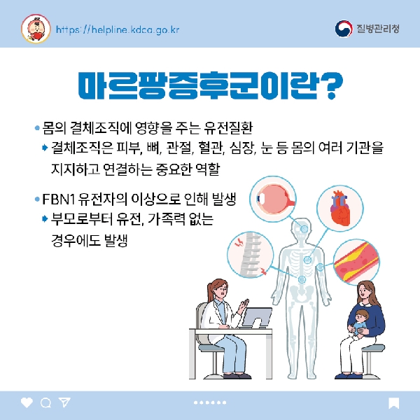 마르팡증후군이란? - 몸의 결체조직에 영향을 주는 유전질환 -> 결체조직은 피부, 뼈, 관절, 혈관, 심장, 눈 등 몸의 여러 기관을 지지하고 연결하는 중요한 역할 - FBN1 유전자의 이상으로 인해 발생 -> 부모로부터 유전, 가족력 없는 경우에도 발생