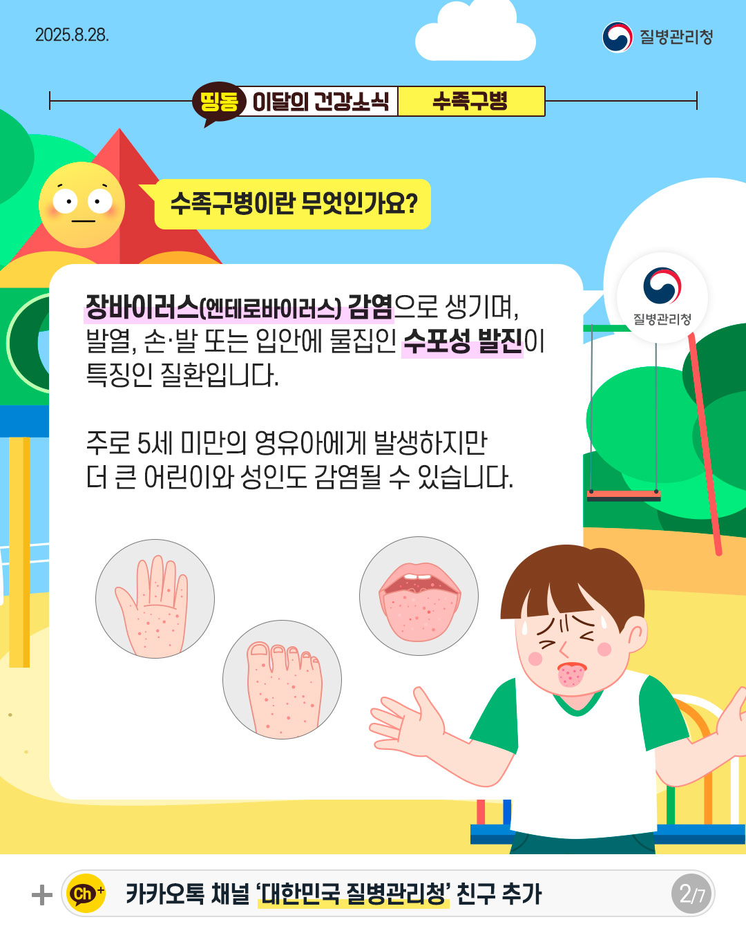 2P 수족구병이란 무엇인가요?  장바이러스(엔테로바이러스) 감염으로 생기며, 발열, 손·발 또는 입안에 물집인 수포성 발진이 특징인 질환입니다.   주로 5세 미만의 영유아에게 발생하지만 더 큰 어린이와 성인도 감염될 수 있습니다. 