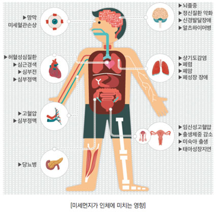 상세설명 아래참조