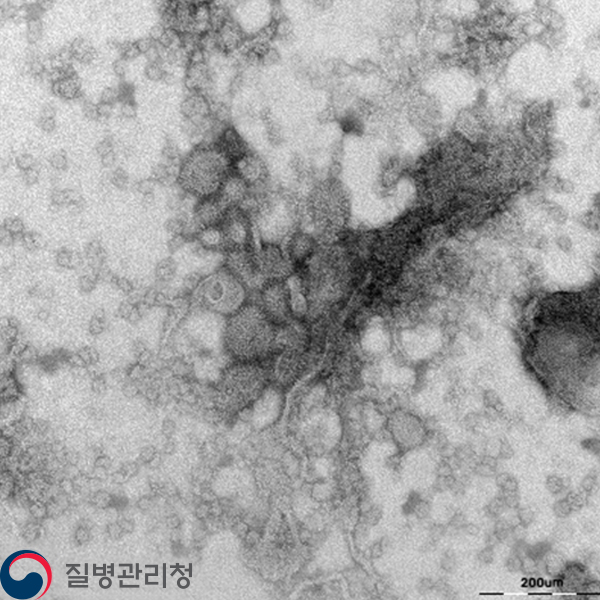 1Respiratory-syncytial-virus