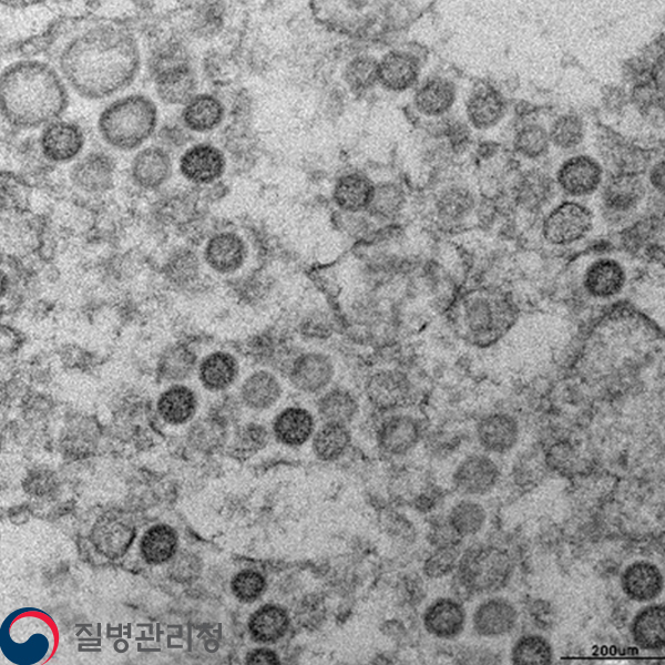 MERS-corona-virus