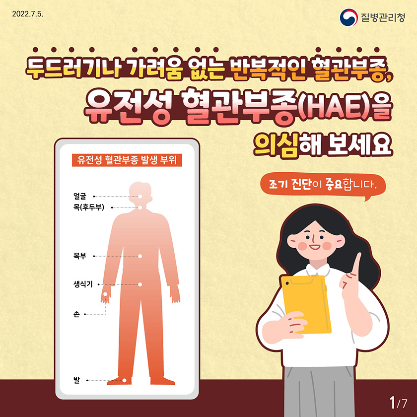 두드러기나 가려움 없는 반복적인 혈관부종, 유전성 혈관부종(HAE)을 의심해 보세요 조기 진단이 중요합니다.