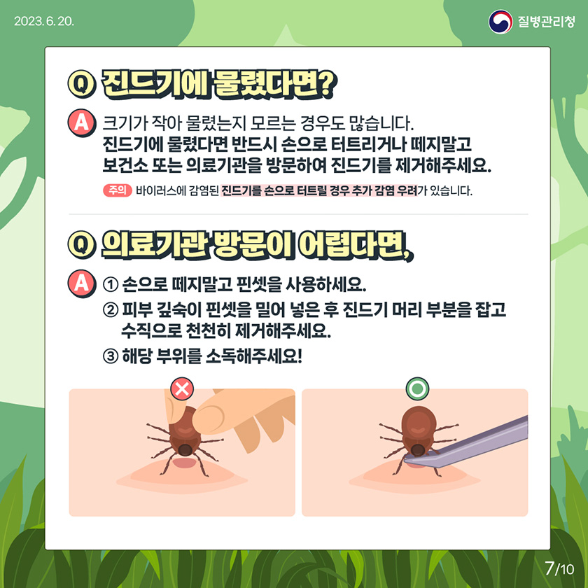 [2023년 6월 30일 질병관리청] Q. 진드기에물렸다면? A. 크기가 작아 물렸는지 모르는 경우도 많습니다. 진드기에 물렸다면 반드시 손으로 터트리거나 떼지말고 보건소 또는 의료기관을 방문하여 진드기를 제거해주세요. 주의 바이러스에 감염된 진드기를 손으로 터트릴 경우 추가 감염 우려가 있습니다. Q. 의료기관방문이 어렵다면, A. 1. 손으로 떼지말고 핀셋을 사용하세요. 2. 피부 깊숙이 핀셋을 밀어 넣은 후 진드기 머리 부분을 잡고 수직으로 천천히 제거해주세요. 3. 해당 부위를 소독해주세요! [10페이지 중 7페이지]