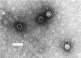Polio virus 병원체 이미지입니다. 