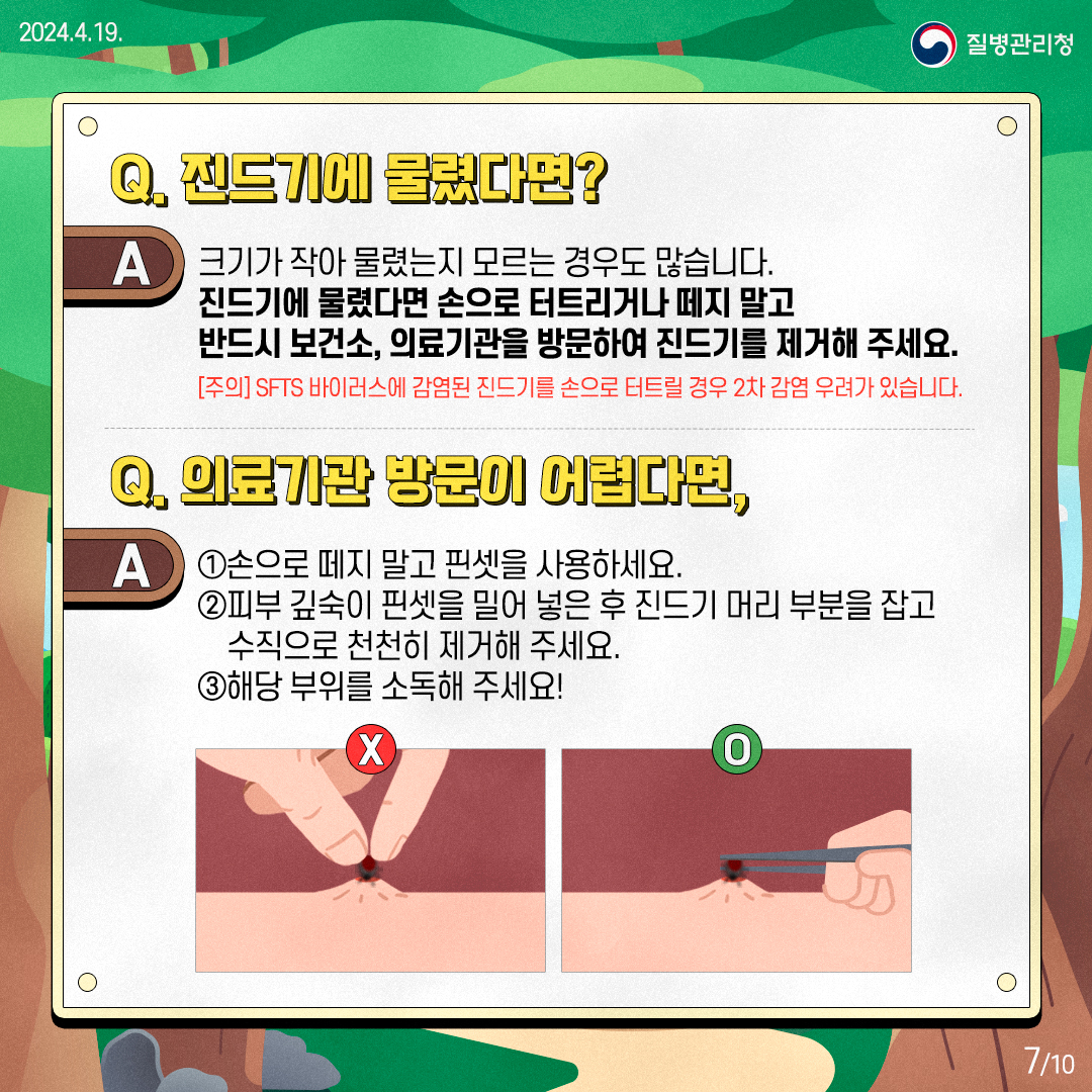 Q. 진드기에 물렸다면? A 크기가 작아 물렸는지 모르는 경우도 많습니다. 진드기에 물렸다면 손으로 터트리거나 떼지 말고 반드시 보건소, 의료기관을 방문하여 진드기를 제거해 주세요. [주의] SFTS 바이러스에 감염된 진드기를 손으로 터트릴 경우 2차 감염 우려가 있습니다. Q. 의료기관 방문이 어렵다면, A 1. 손으로 떼지 말고 핀셋을 사용하세요. 2. 피부 깊숙이 핀셋을 밀어 넣은 후 진드기 머리 부분을 잡고 수직으로 천천히 제거해 주세요. 3. 해당 부위를 소독해 주세요!