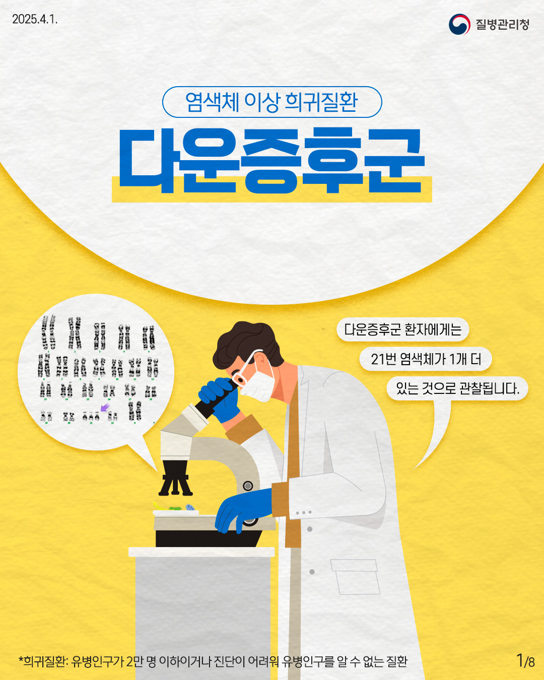 염색체 이상 희귀질환 다운증후군  다운증후군 환자에게는 21번 염색체가 1개 더 있는 것으로 관찰됩니다.  *희귀질환: 유병인구가 2만 명 이하이거나 진단이 어려워 유병인구를 알 수 없는 질환