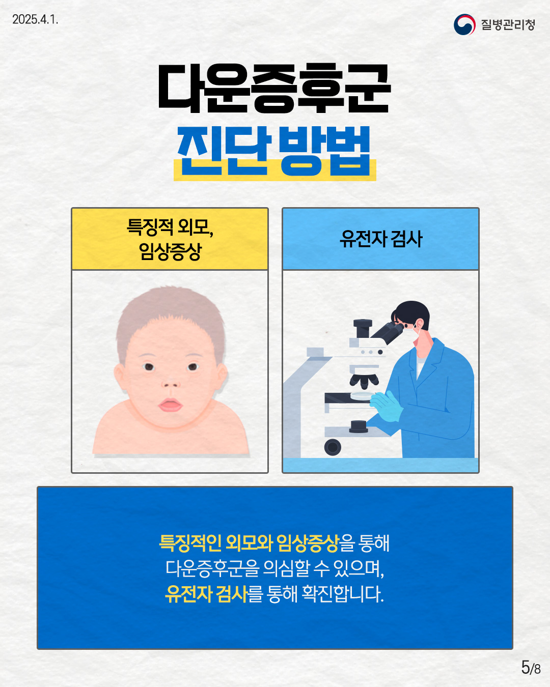 다운증후군 진단방법  - 특징적 외모, 임상증상 - 유전자 검사  특징적인 외모와 임상증상을 통해 다운증후군을 의심할 수 있으며, 유전자검사를 통해 확진합니다.