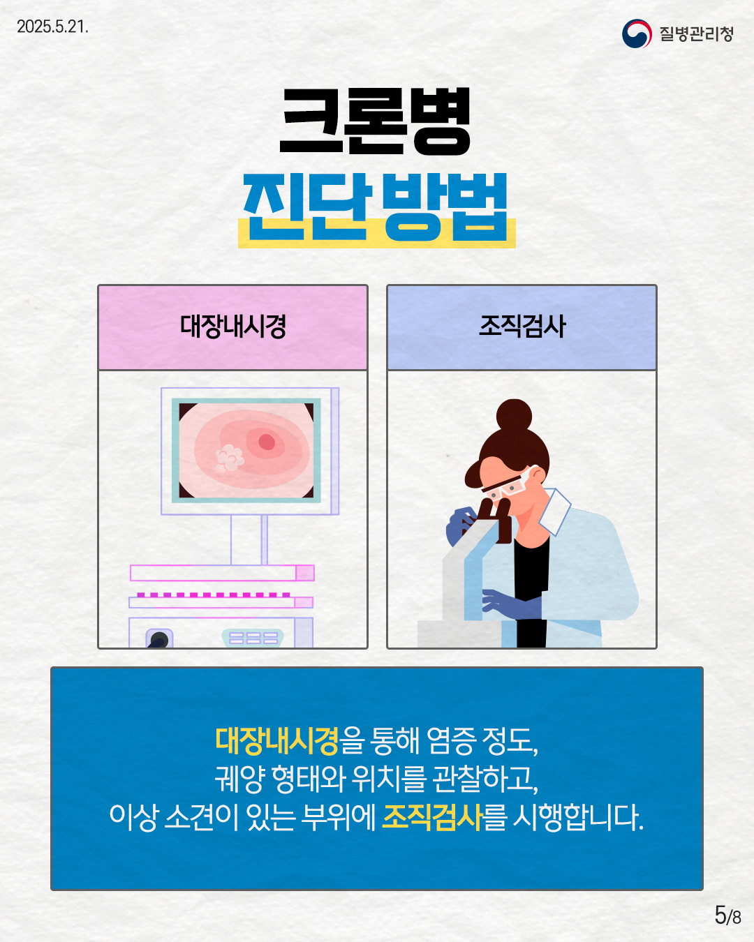 2025.5.21. 질병관리청 <크론병 진단방법> - 대장내시경 - 조직검사 대장내시경을 통해 염증 정도, 궤양 형태와 위치를 관찰하고, 이상 소견이 있는 부위에 조직검사를 시행합니다. 5p
