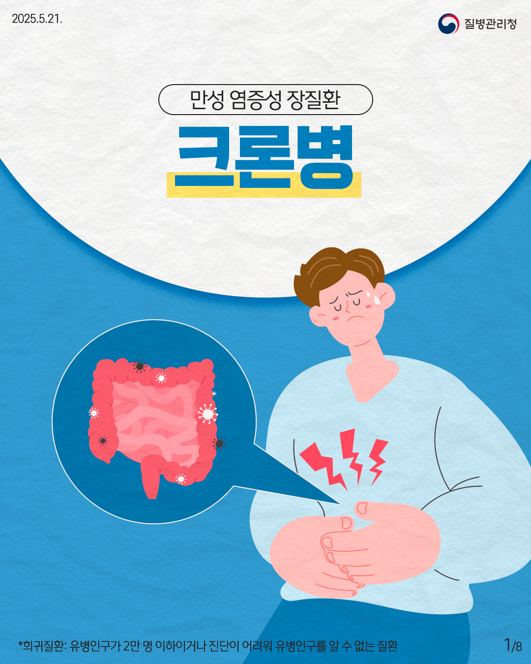 2025.5.21. 질병관리청 만성 염증성 장질환 크론병 *희귀질환: 유병인구가 2만 명 이하이거나 진단이 어려워 유병인구를 알 수 없는 질환 1p