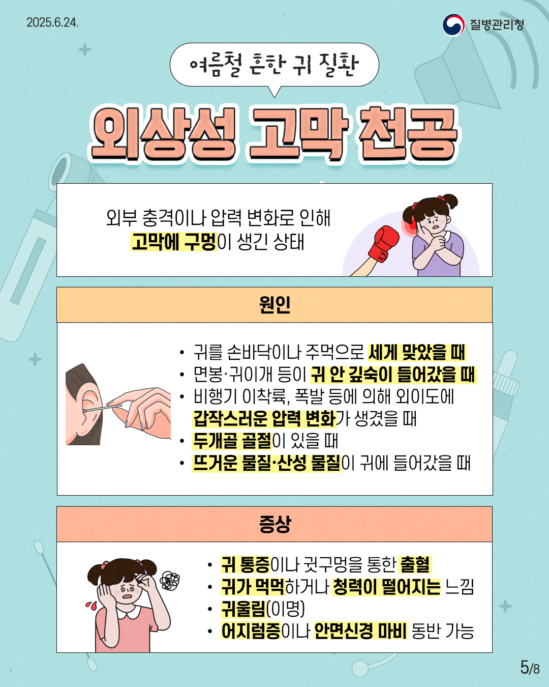 2025.6.24. 질병관리청 5P 여름철 흔한 귀 질환 외상성 고막 천공 외부 충격이나 압력 변화로 인해 고막에 구멍이 생긴 상태 원인 • 귀를 손바닥이나 주먹으로 세게 맞았을 때 • 면봉, 귀이개 등이 귀 안 깊숙이 들어갔을 때 • 비행기 이착륙, 폭발 등에 의해 외이도에 갑작스러운 압력 변화가 생겼을 때 • 두개골 골절이 있을 때 • 뜨거운 물질·산성 물질이 귀에 들어갔을 때 증상 • 귀 통증이나 귓구멍을 통한 출혈 • 귀가 먹먹하거나 청력이 떨어지는 느낌 • 귀울림(이명) • 어지럼증이나 안면신경 마비 동반 가능