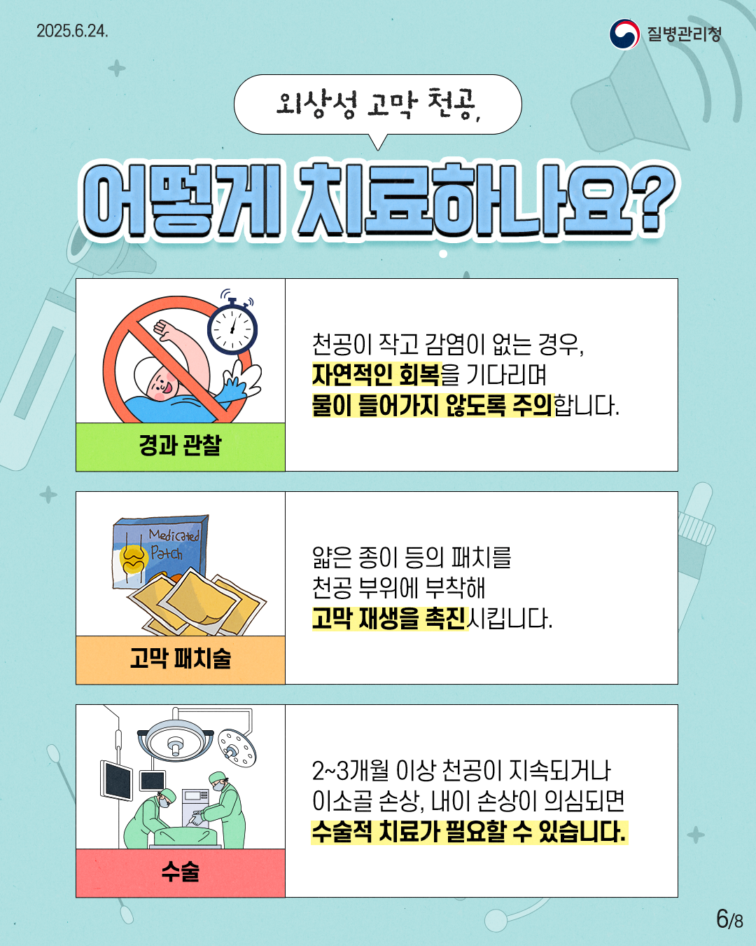 2025.6.24. 질병관리청 6P 외상성 고막 천공, 어떻게 치료하나요? 경과 관찰 천공이 작고 감염이 없는 경우, 자연적인 회복을 기다리며 물이 들어가지 않도록 주의합니다. 고막 패치술 얇은 종이 등의 패치를 천공 부위에 부착해 고막 재생을 촉진시킵니다. 수술 2~3개월 이상 천공이 지속되거나 이소골 손상, 내이 손상이 의심되면 수술적 치료가 필요할 수 있습니다.