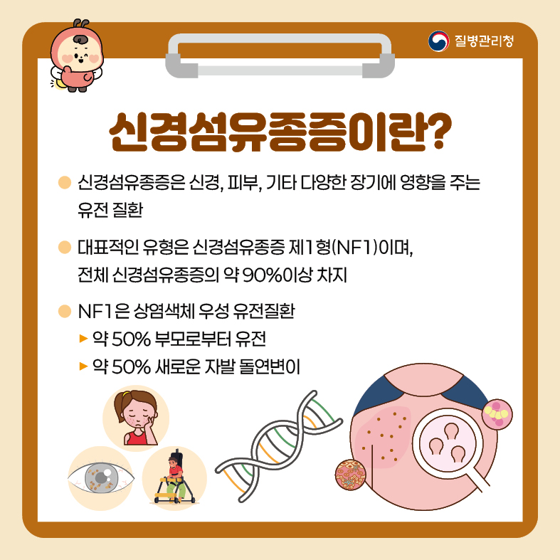 1. 신경섬유종증이란? - 신경섬유종증은 신경, 피부, 기타 다양한 장기에 영향을 주는 유전 질환 - 대표적인 유형은 신경섬유종증 제1형(NF1)이며, 전체 신경섬유종증의 약 90%이상 차지 - NF1은 상염색체 우성 유전질환  · 약 50% 부모로부터 유전  · 약 50% 새로운 자발 돌연변이