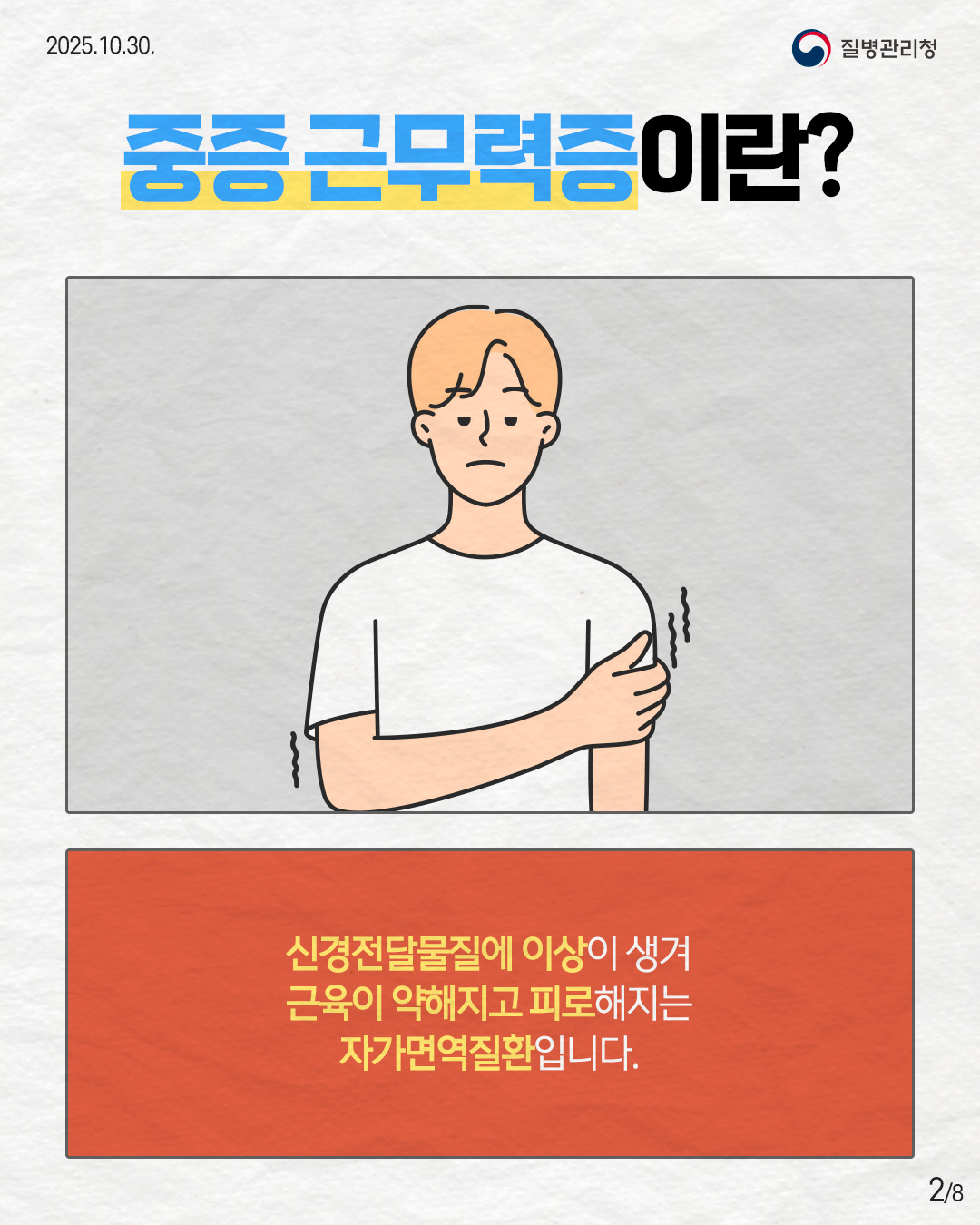 2P 중증 근무력증이란?  신경전달물질에 이상이 생겨 근육이 약해지고 피로해지는 자가면역질환입니다.