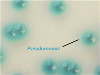 P. aeruginosa 균 섭시 37도 24시간 에서 48시간 배양후 현미경 이미지