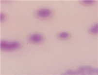 Salmonella spp. 균 섭시 37도 24시간 에서 48시간 배양후 현미경 이미지