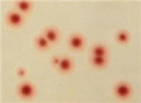 Campylobacter spp. 균 섭시 42도 72시간 배양후 현미경