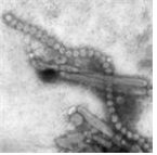 Avian influenza virus affecting human 병원체 이미지입니다. 