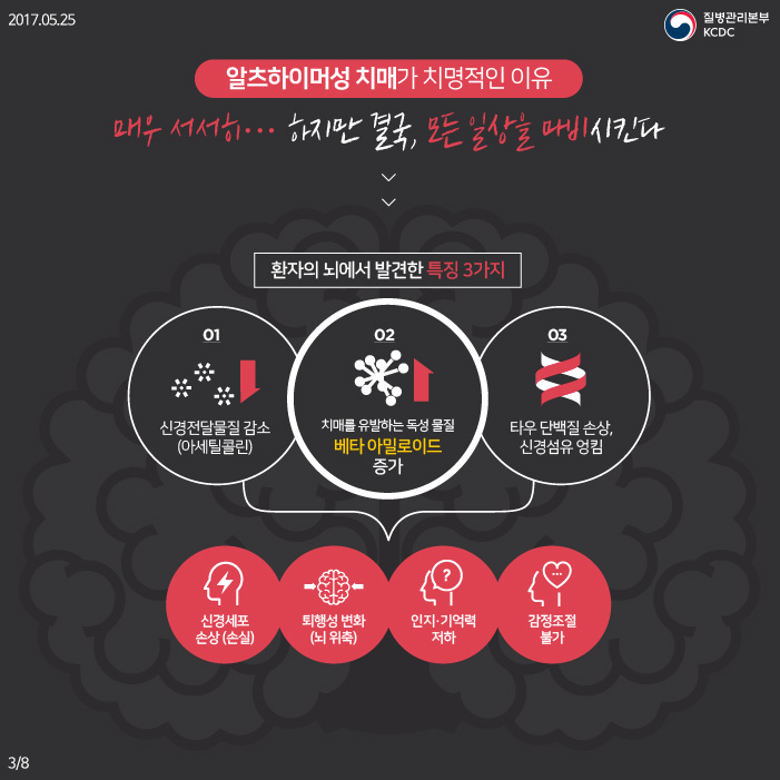 알츠하이머성 치매, 나를 잃지 않고 지키는 방법 사진5