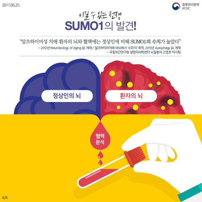 알츠하이머성 치매, 나를 잃지 않고 지키는 방법 사진6