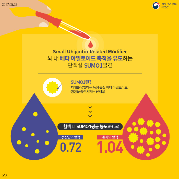 알츠하이머성 치매, 나를 잃지 않고 지키는 방법 사진7