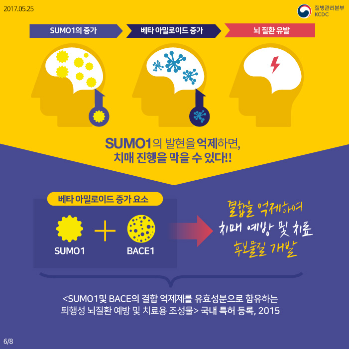 알츠하이머성 치매, 나를 잃지 않고 지키는 방법 사진8