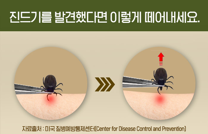 진드기를 발견했다면 이렇게 떼어내세요. 자료출처:미국 질병예방통제센터(Center for Disease Control and Prevention)