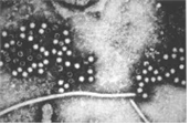 Hepatitis E virus(Orthohepevirus A) 병원체 이미지입니다. 