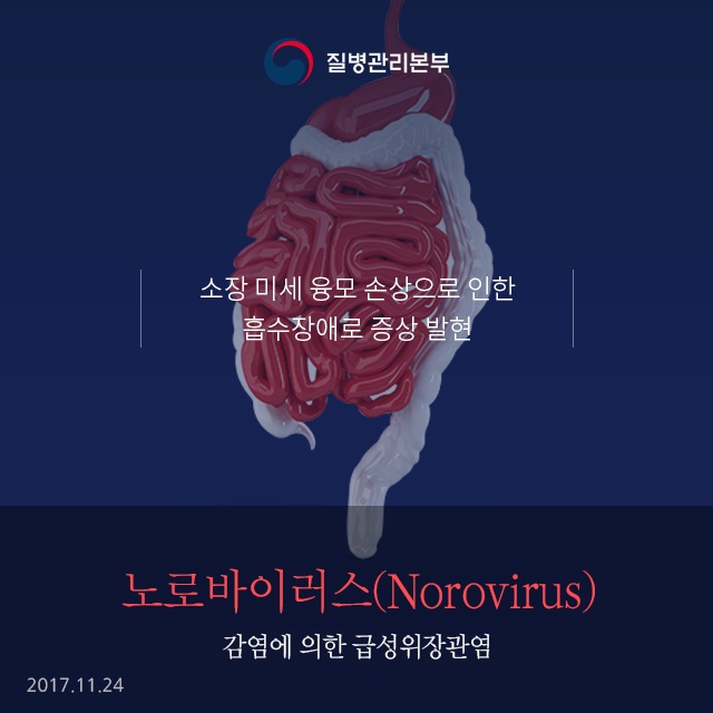 노로바이러스 감염증 알아보기 사진4