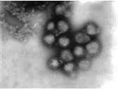 Influenza A virus 병원체 이미지입니다.