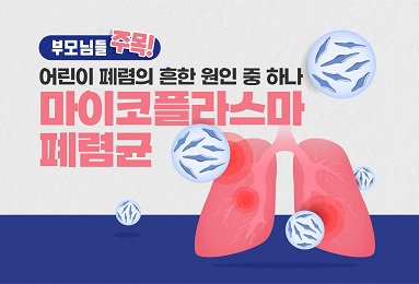 어린이 폐렴의 원인 중 하나, 마이코플라스마 폐렴균 감염증