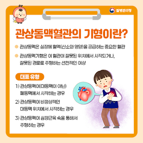 1. 관상동맥혈관의 기형이란?
- 관상동맥은 심장에 혈액(산소와 영양)을 공급하는 중요한 혈관
- 관상동맥기형은 이 혈관이 잘못된 위치에서 시작되거나, 잘못된 경로로 주행하는 선천적인 이상