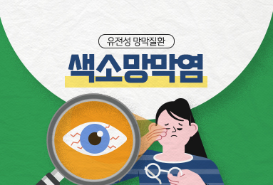 유전성 망막질환
색소망막염
*희귀질환: 유병인구가 2만 명 이하이거나 진단이 어려워 유병인구를 알 수 없는 질환