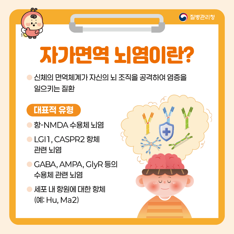 자가면역 뇌염