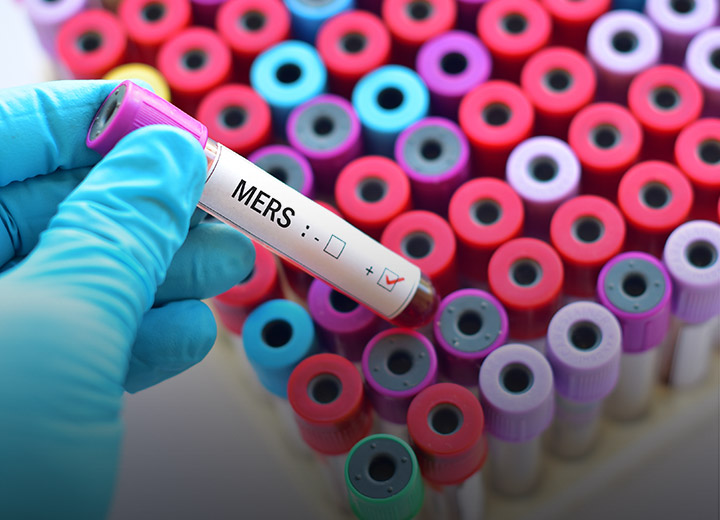 Middle East Respiratory Syndrome (MERS)