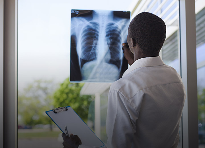National TB Elimination Project